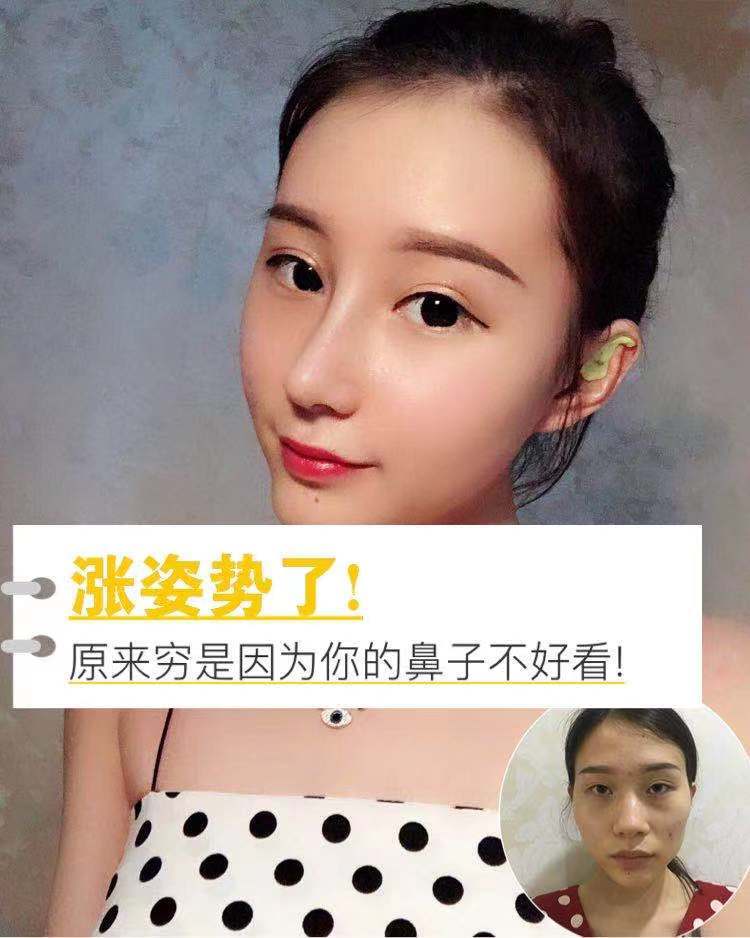 着不同的含义鼻头有肉,命里有财鼻如刀削,妻财两抛鼻梁鼻头丰满有肉