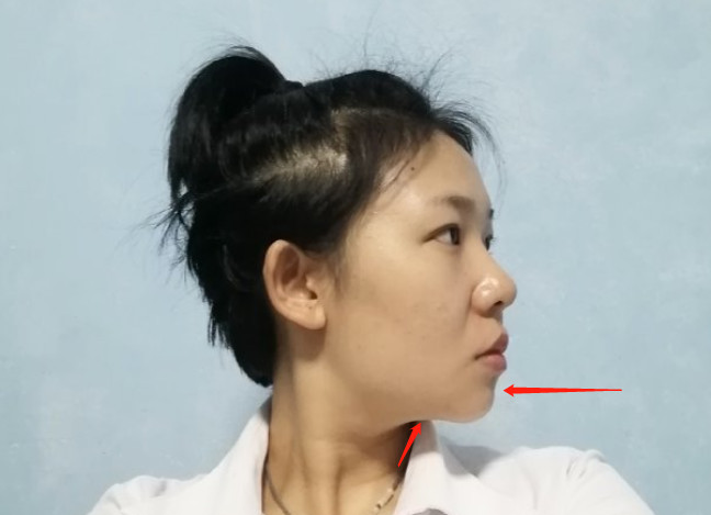 我觉着还好.实在介意的话,可以垫一下下巴 颏肌放松.