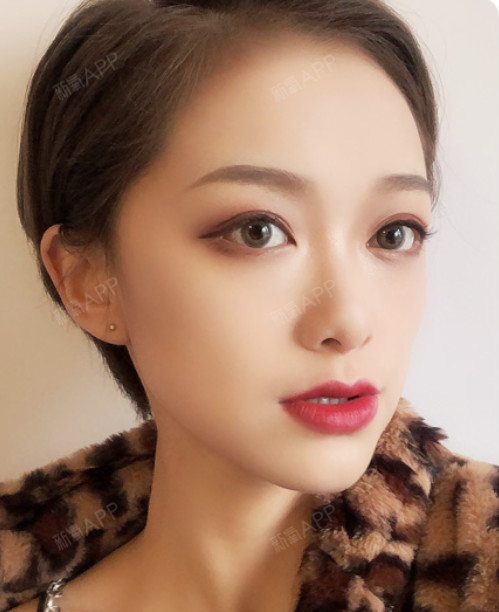 大脸盘子杀手----面部吸脂很多美女拥有魔鬼般的身