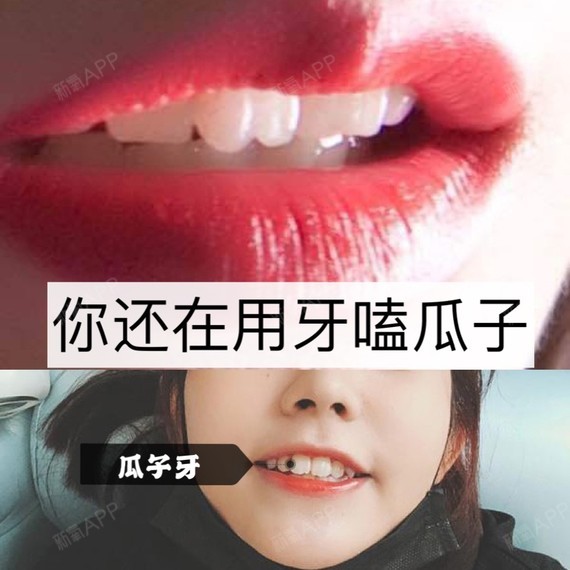 爱"嗑瓜子"的你要当心啦!