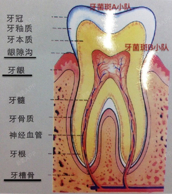 正确的洗牙,用牙线是不会让牙缝变大的