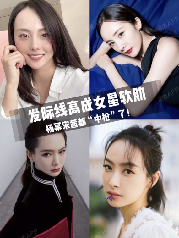 杨幂宋茜被diss发际线高,女明星真不容易啊!