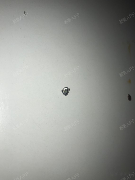 牙齿矫正