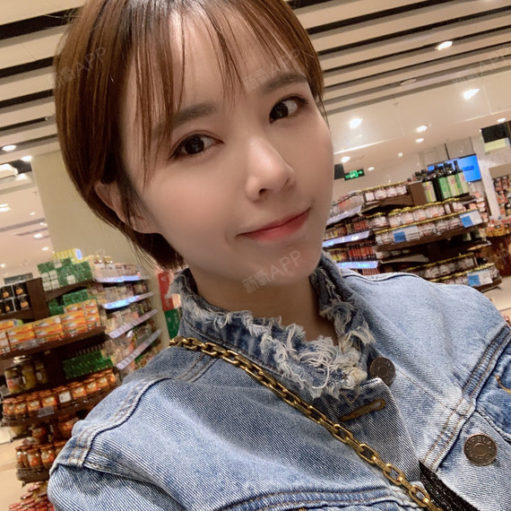 项目:自体脂肪全脸填充医生:杨硕成恢复:现在应该是
