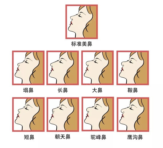 (左:鼻缺损 右:鼻歪 2,功能正常 形态不100"标准"