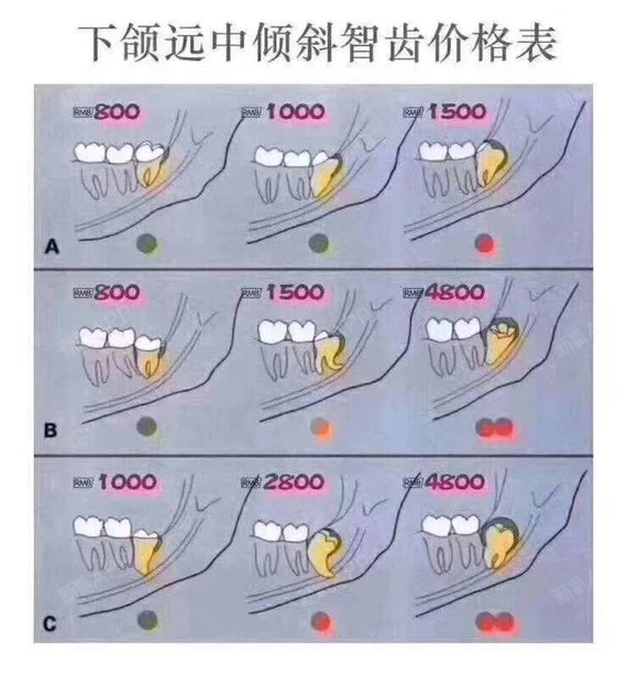 在网络上,经常有一些患者在询问:拔个智齿,怎么这么