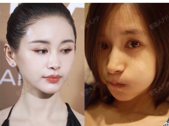 有种"整容"叫王子文长发,却意外撞脸美过杨幂