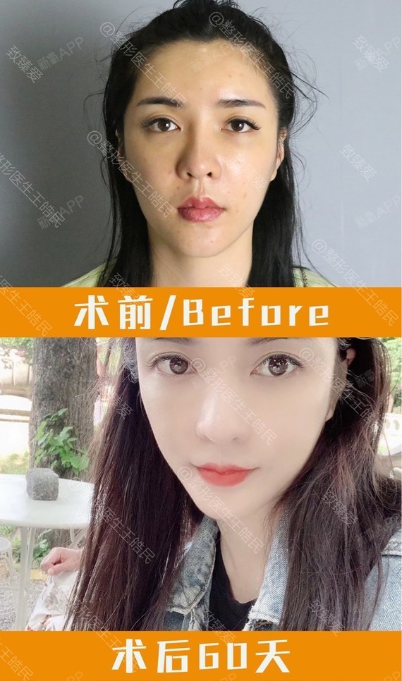 越南流行的花瓣唇你get吗?