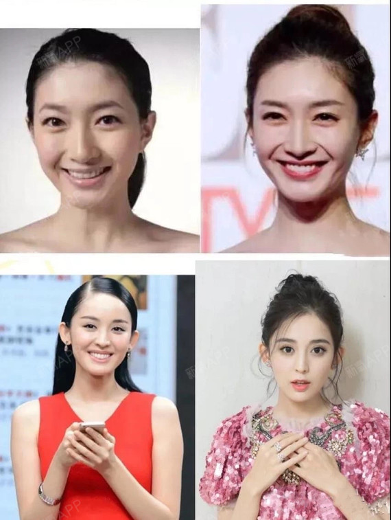 一个好看的颅顶非常少见,不仅大多数普通人做不到这一点,很多女明星也