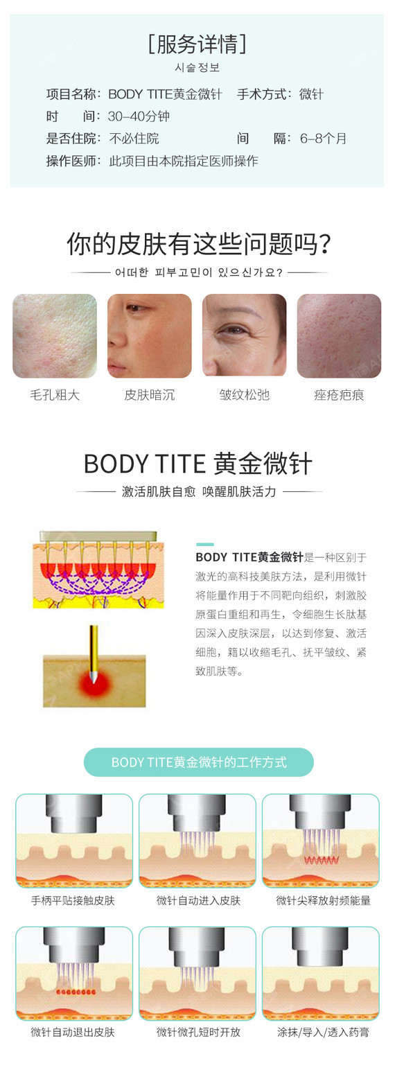 【黄金微针】①bodytite全面部黄金微针②痘印痘坑/收缩毛孔/妊娠纹