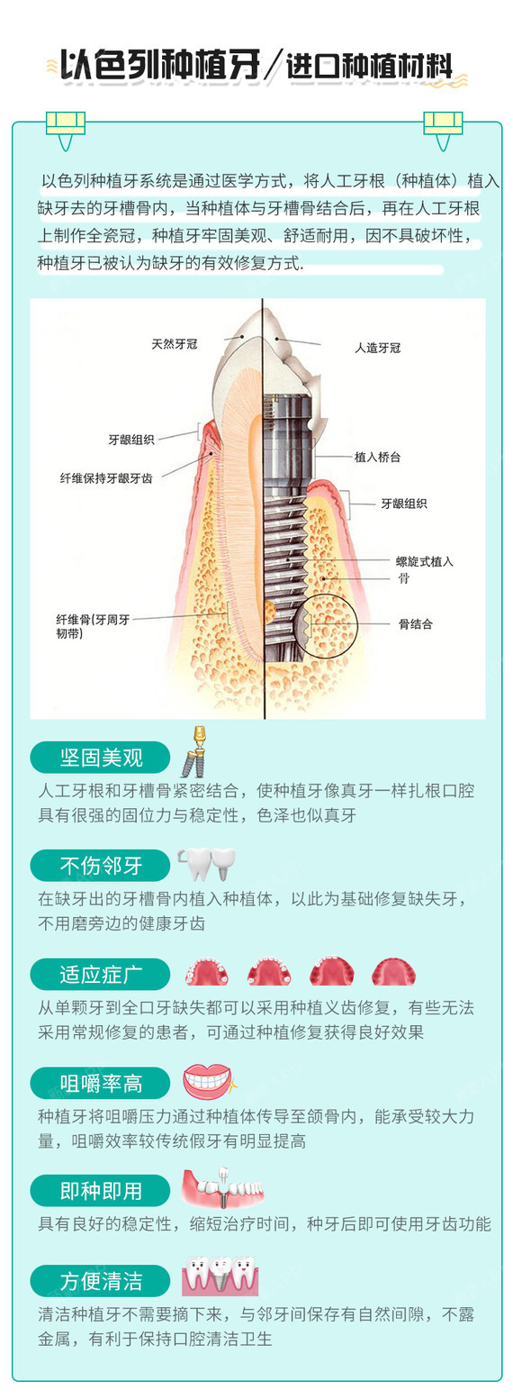 长期质保 以色列种植体 即刻种植 坚固耐用 好牙享口福