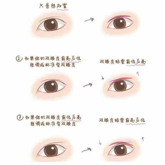你的双眼皮属于哪种类型?