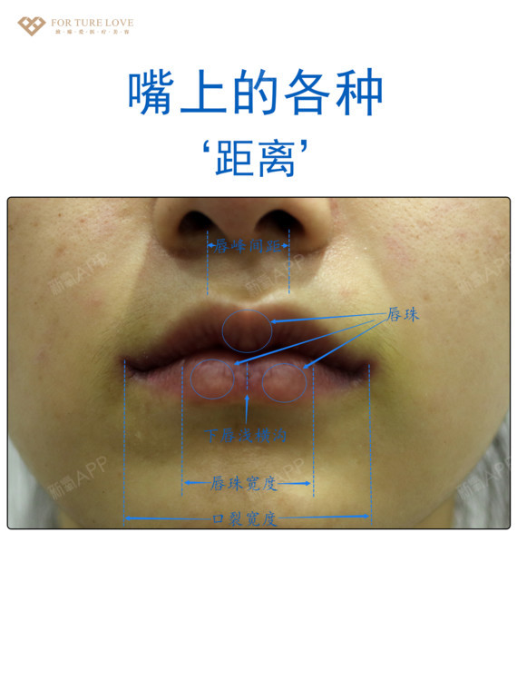 唇部结构最全解析有图有真相