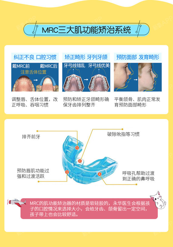 【隐形矫正】儿童早期矫正mrc地包天龅牙牙齿不齐预防