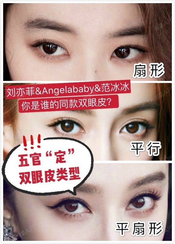 平行,平扇形,拿影视明星来举例: 刘亦菲的双眼皮属于扇形双眼皮,她的