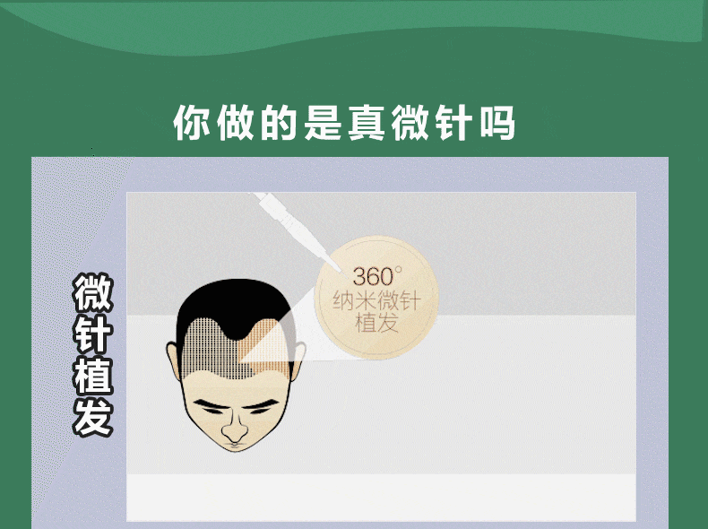【津贴优惠】【种植眉毛】【科发源·ztc眉毛种植 】