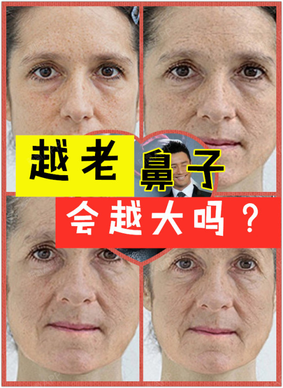 越老鼻子会越大吗?