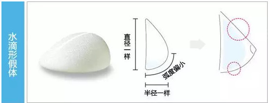 也称解剖型乳房假体,水滴形假体较大的特点是突度上下不对称,模仿人