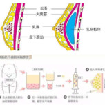 雌激素越多,胸就能变得越大?