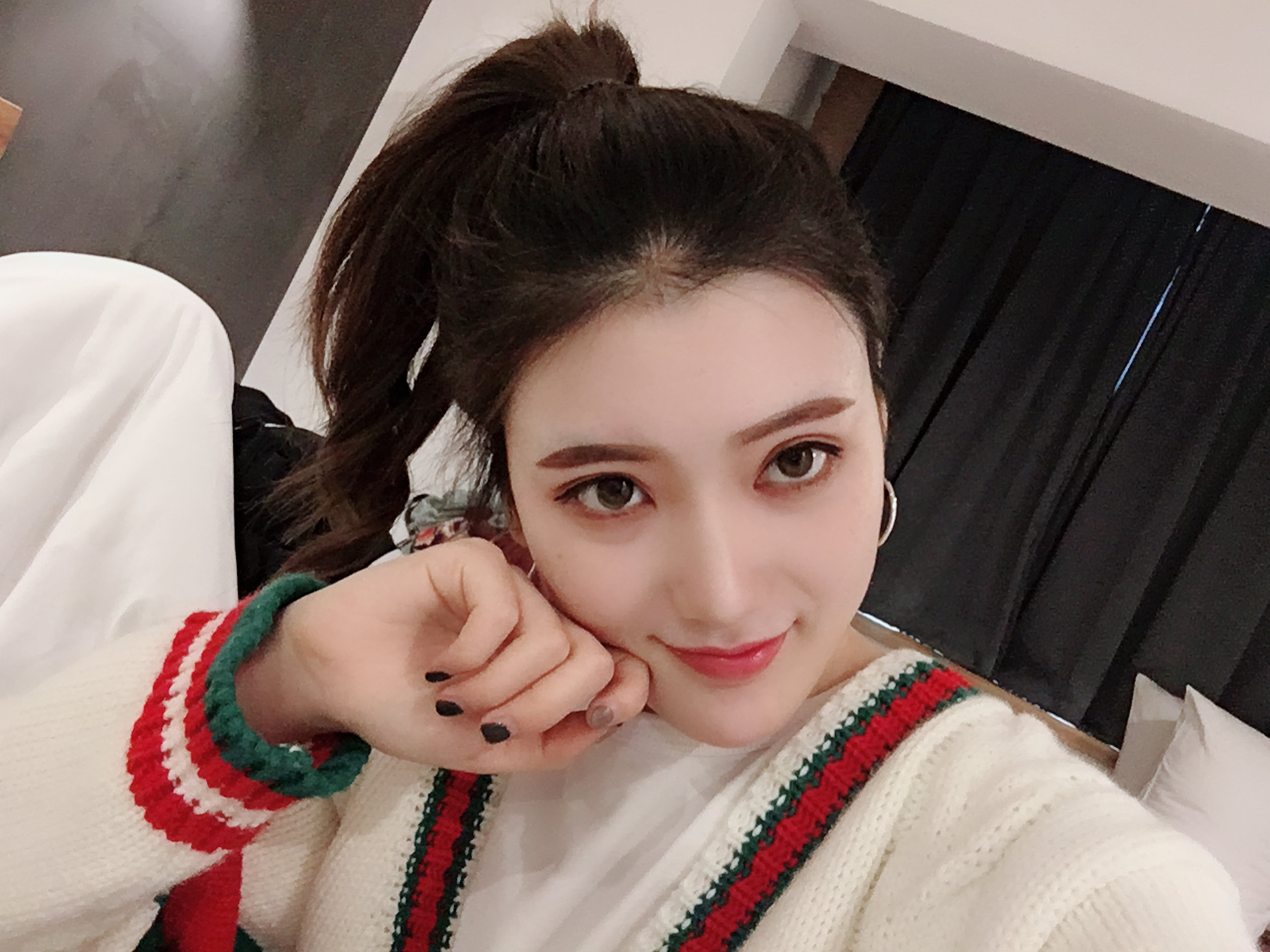 武汉新至美医疗美容自体脂肪全脸填充怎么样_恢复过程