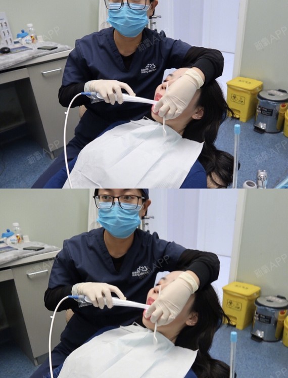 洗牙/洁牙