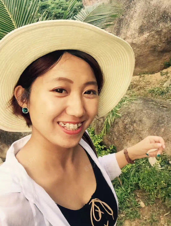 唇红齿白,牙套 种植全攻略