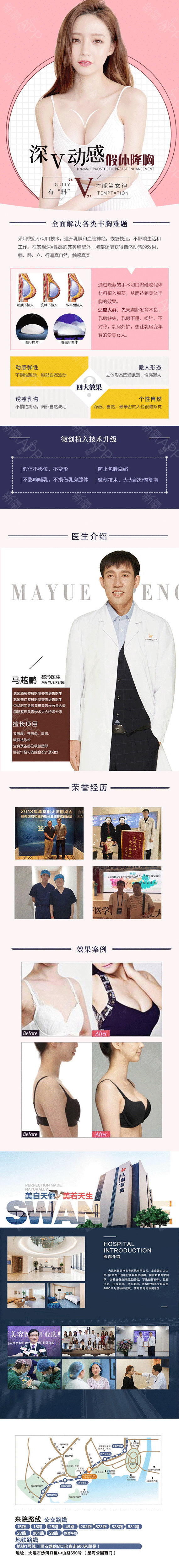 【假体隆胸】威宁假体曼陀/傲诺拉 手感真实自然,饱满