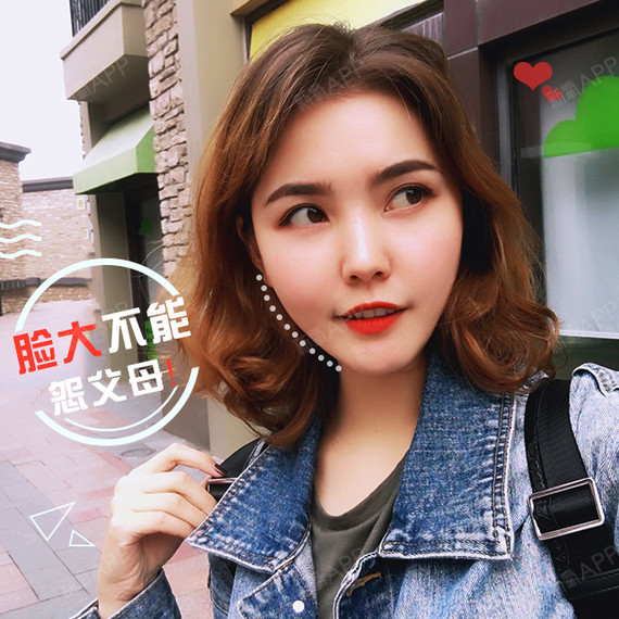 原来由于颧骨高,面部凹陷显得脸大而没精神,通过自体脂肪和瘦脸针的