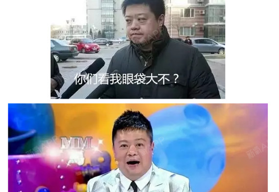 马东割眼袋前后对比震惊了做了眼袋手术应该注意什么