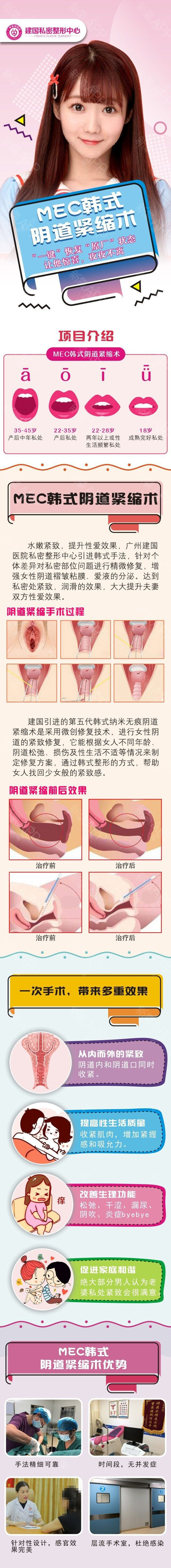 【手术紧缩阴道】#私密专院#【mec手术缩阴】@周娜①不住院不拆线②