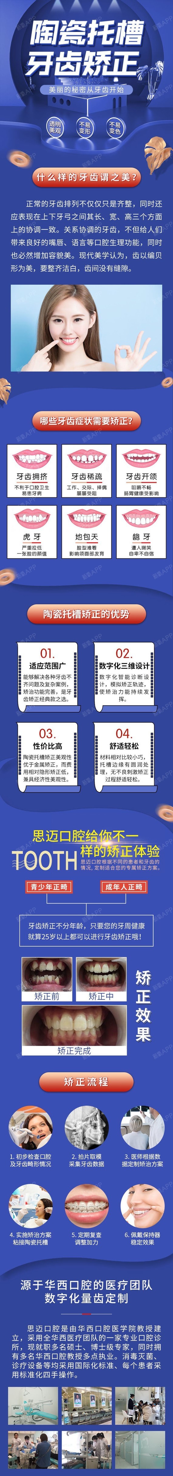 陶瓷半隐形托槽矫治器,非陶瓷自锁矫治器