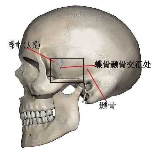 同时,蝶骨与颞骨的交汇处,其实也是我们视觉判断太阳穴最低点的位置