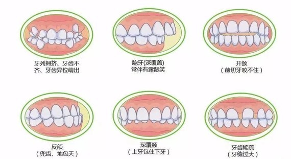 牙齿对颜值的影响到底有多重要