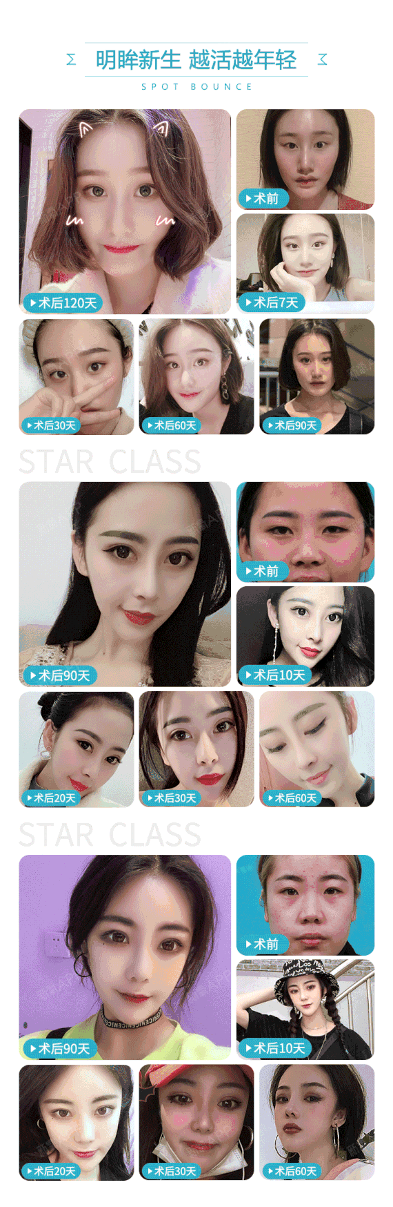 【眼部多项】奥斯卡 美眼 睁眼有神 闭眼隐痕