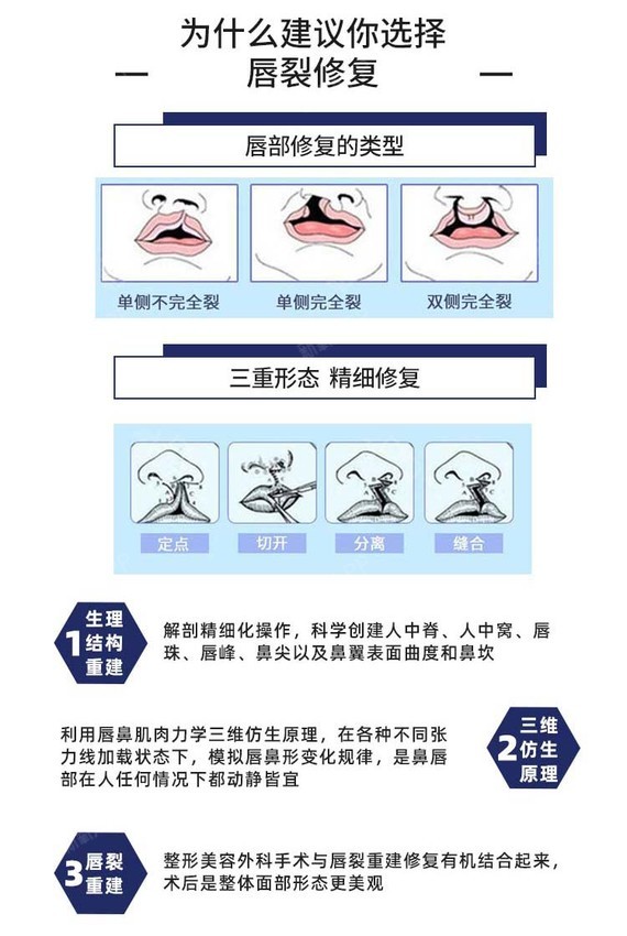 【厚唇改薄】三级整形外科医院 兔唇修复 精致修复唇部 /专家亲诊