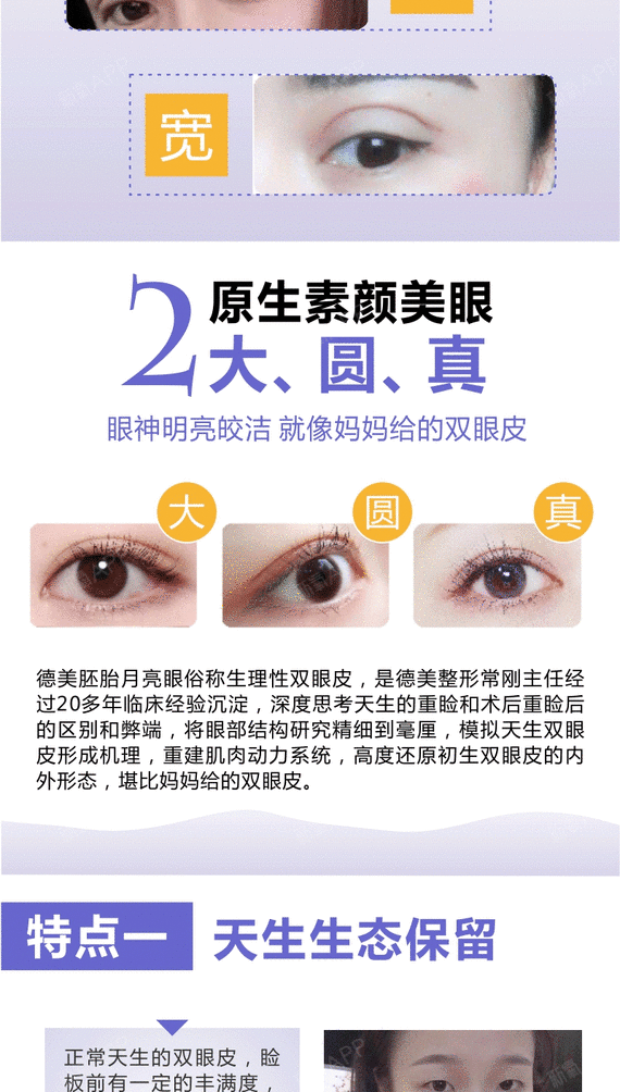 【眼部综合】眼部精雕综合胚胎月亮眼/自然隐痕灵动胎生双眼皮/娃娃脸