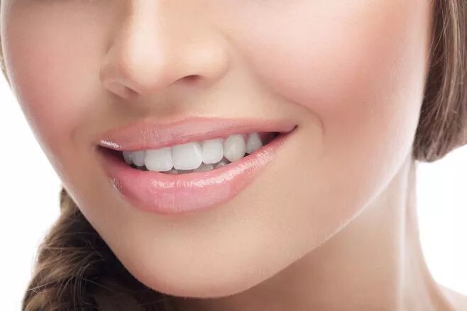 今日新氧女孩 #牙齿好看会给颜值加分拥有一口整洁漂亮的牙齿是现代