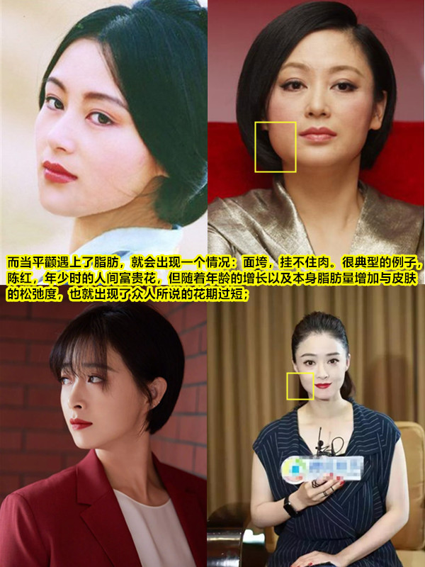 97平颧骨和高颧骨都可以很有高级感979797它们都必须建_圈子