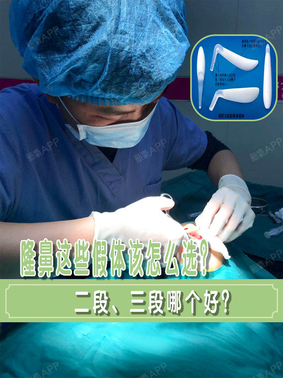 隆鼻这些假体该怎么选?二段,三段哪个好?