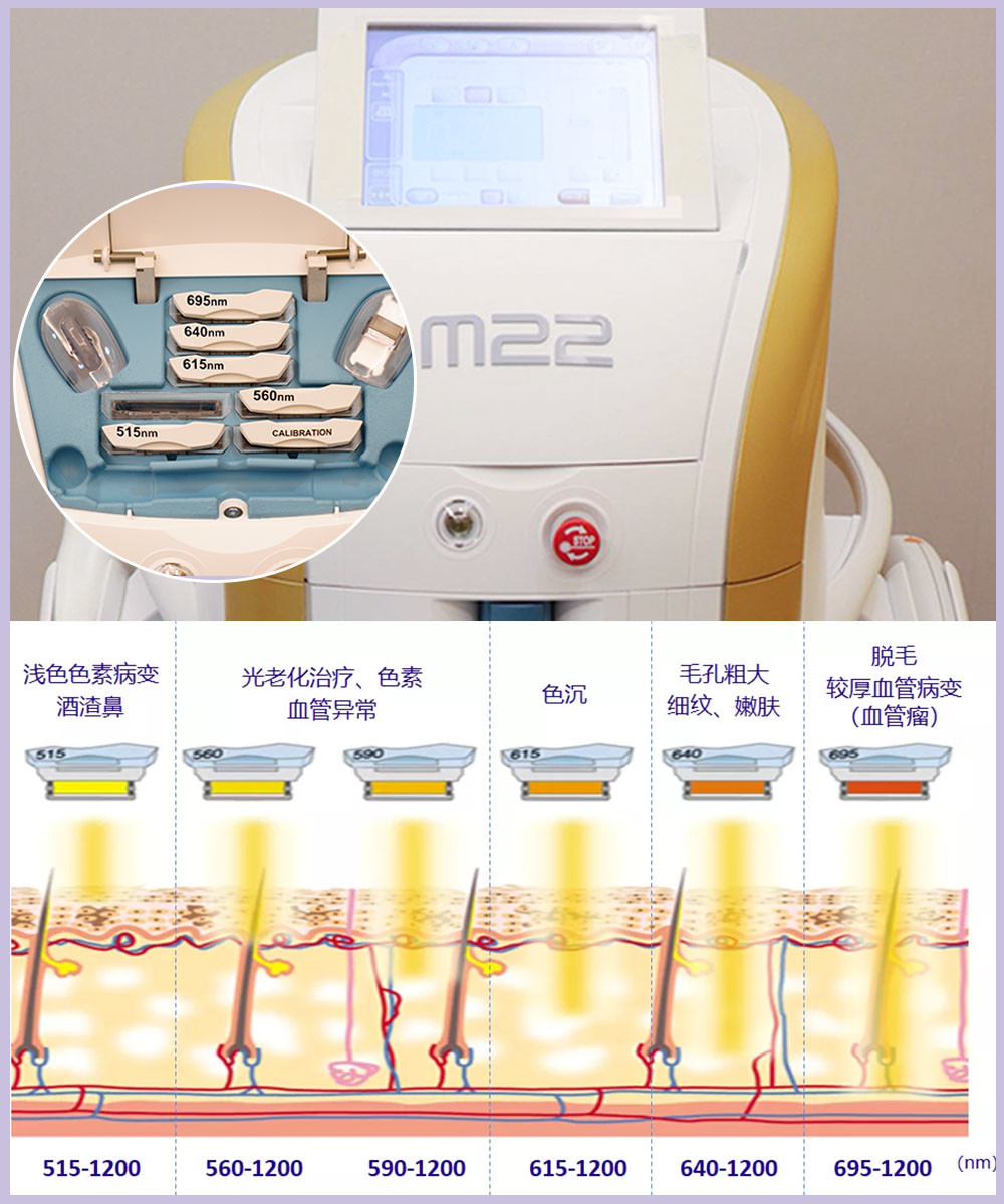 科医人第七代m22超光子嫩肤 99新一代m22超光子_圈子-新氧美容整形