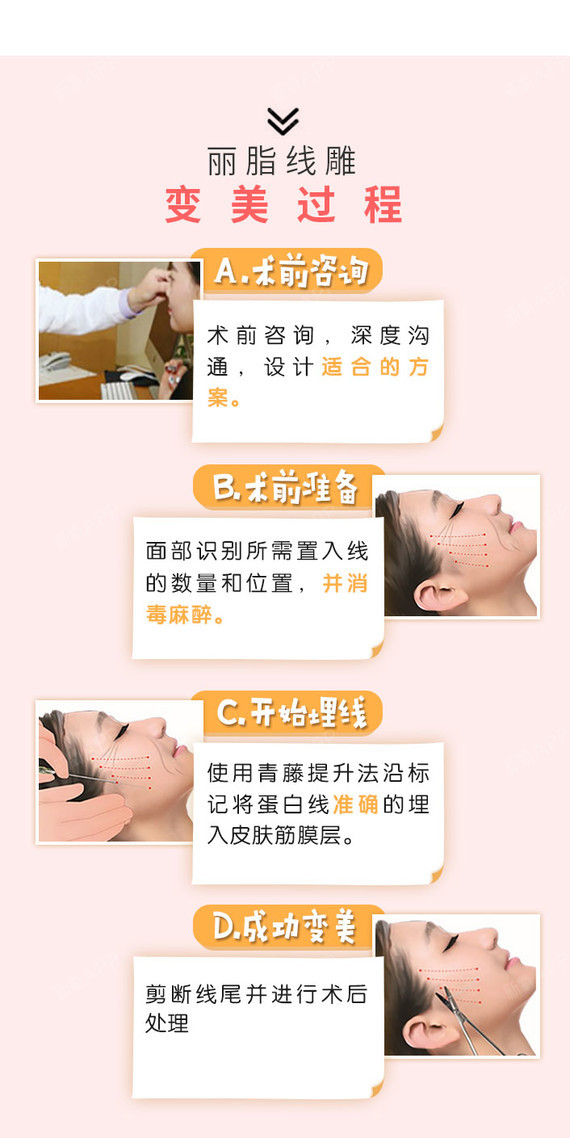 【埋线提升】韩国美迪塑线 全面部线雕 上/中/下面部提升 多维青藤