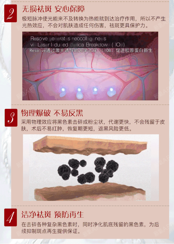【皮秒激光】画美.