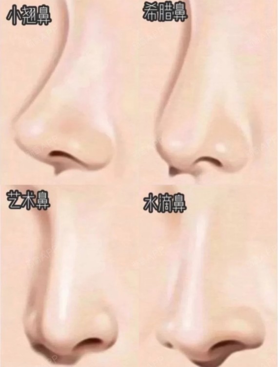 世界好看公认的鼻型!无数集美的隆鼻模版鼻子占据面部