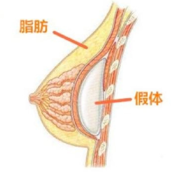 为什么隆胸前后男人的态度会180度大转弯