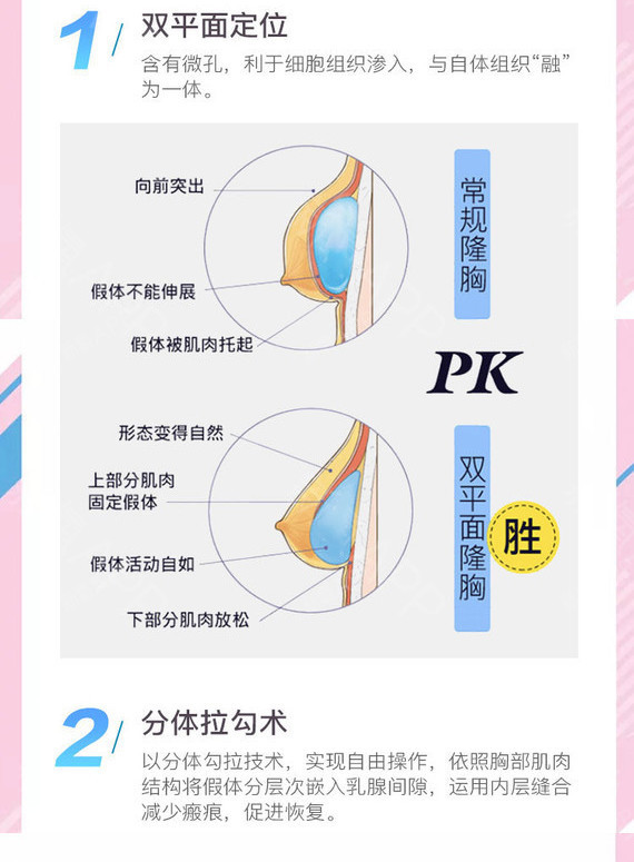 【假体隆胸】威宁之星假体隆胸/曼托假体隆胸/傲诺拉假体隆胸 可升级