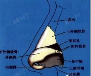 能否正确认识侧鼻软骨和鼻翼软骨的解剖学结构,决定着鼻整形手术的