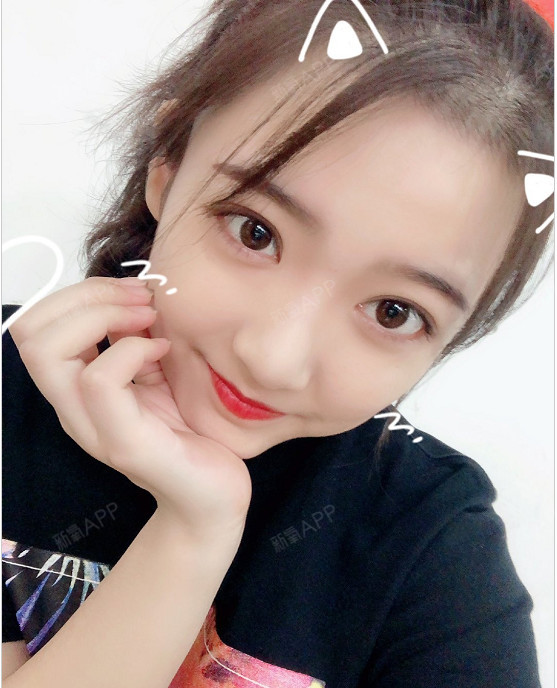 割双眼皮,面诊这一步很关键
