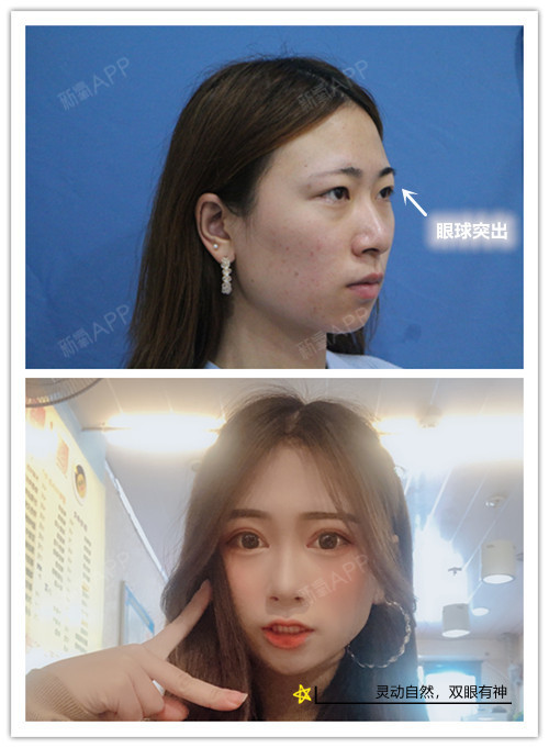 金鱼眼的自我拯救秘籍!