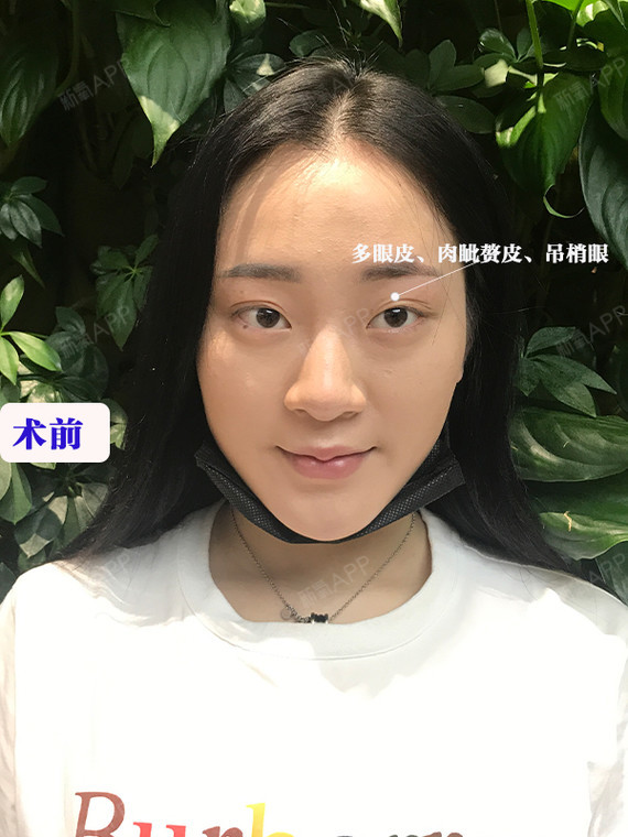 萌妹子怎能让"吊梢眼"拉低颜值!
