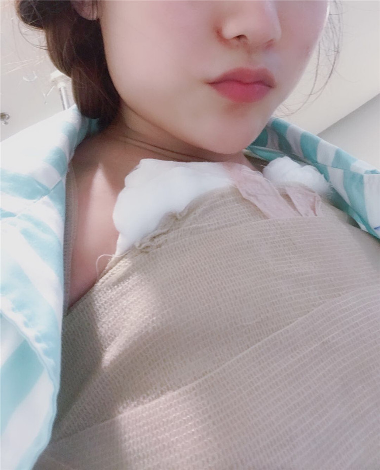 科普:假体隆胸术后痛吗